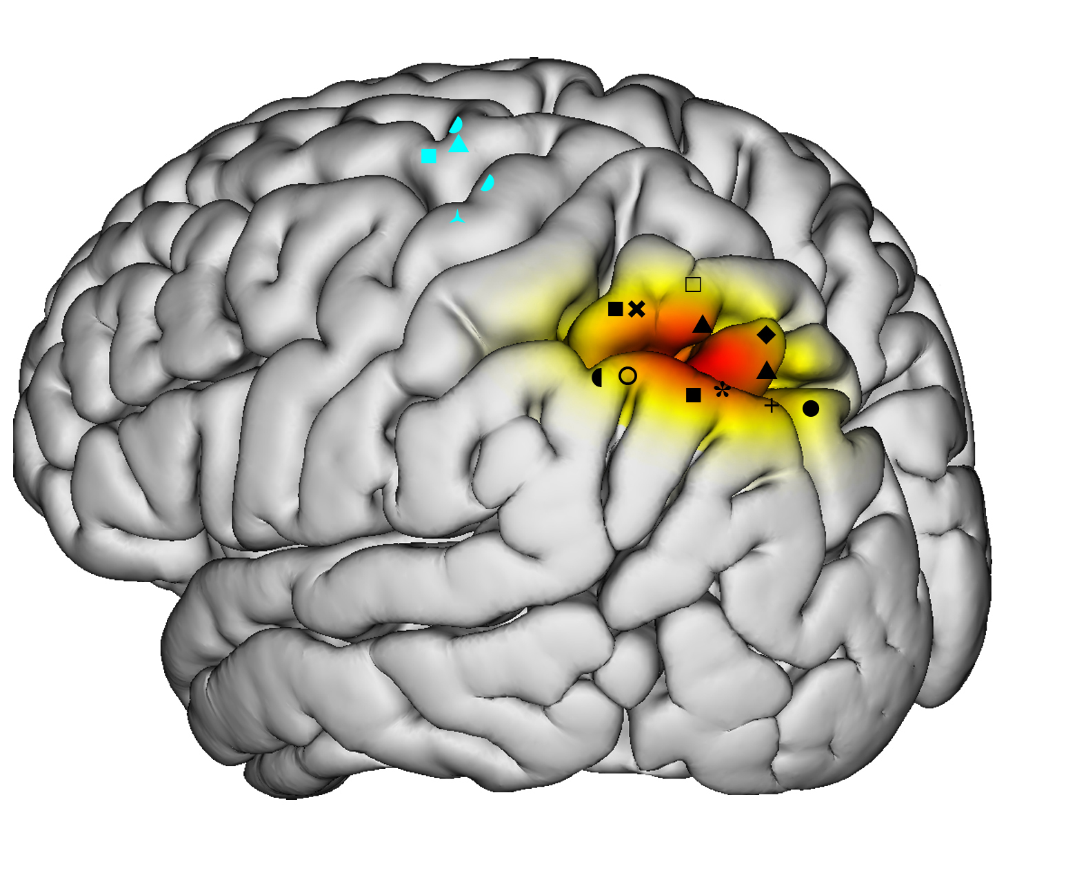Cortical stimulation map